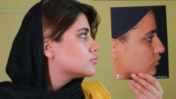 یکی از پر بازدیدترین ویدیوهای جراحی بینی اتاق عمل در اینستاگرام دکتر هادی سرمست