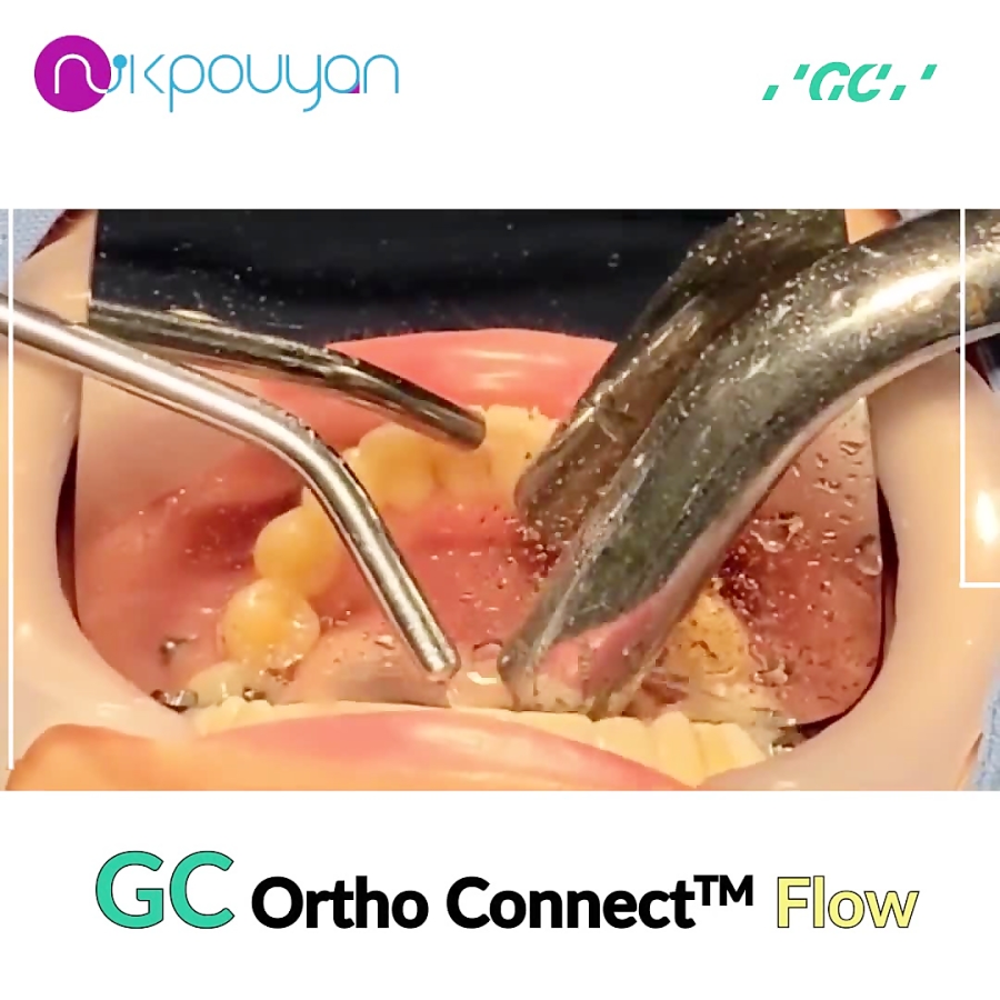 GC Ortho Connect flow