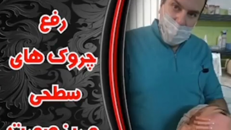 رفع چروکهای سطحی و ریز صورت با نخ اصلاح فرم صورت