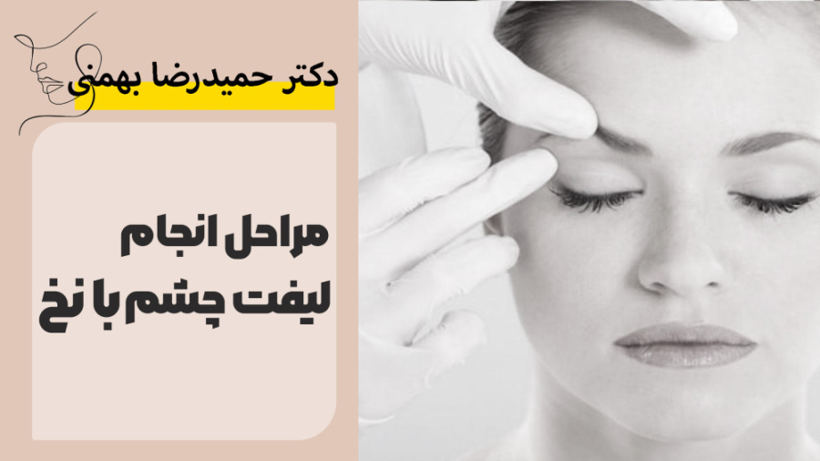 مراحل انجام لیفت چشم با نخ تزریق بوتاکس
