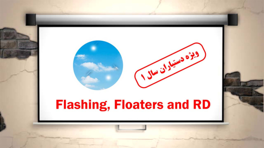 Flashing, Floaters and RD H.Faghihi MD 1399.10.07