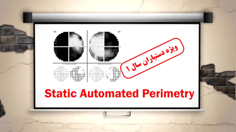 Static Automated Perimetry -Gh.fakhraei MD -1399.10.20 تزریق چربی