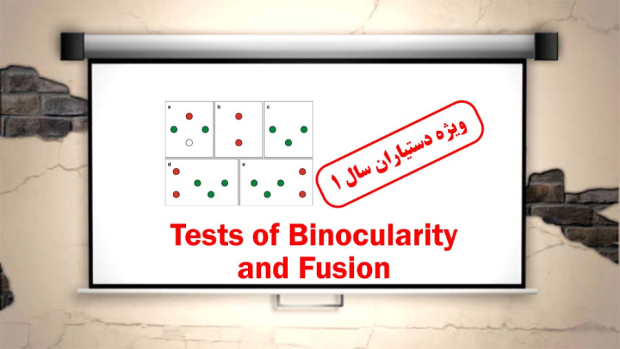 Tests of Binocularity and Fusion - M.R.Akbari MD - 1399.11.08 لیفت پیشانی