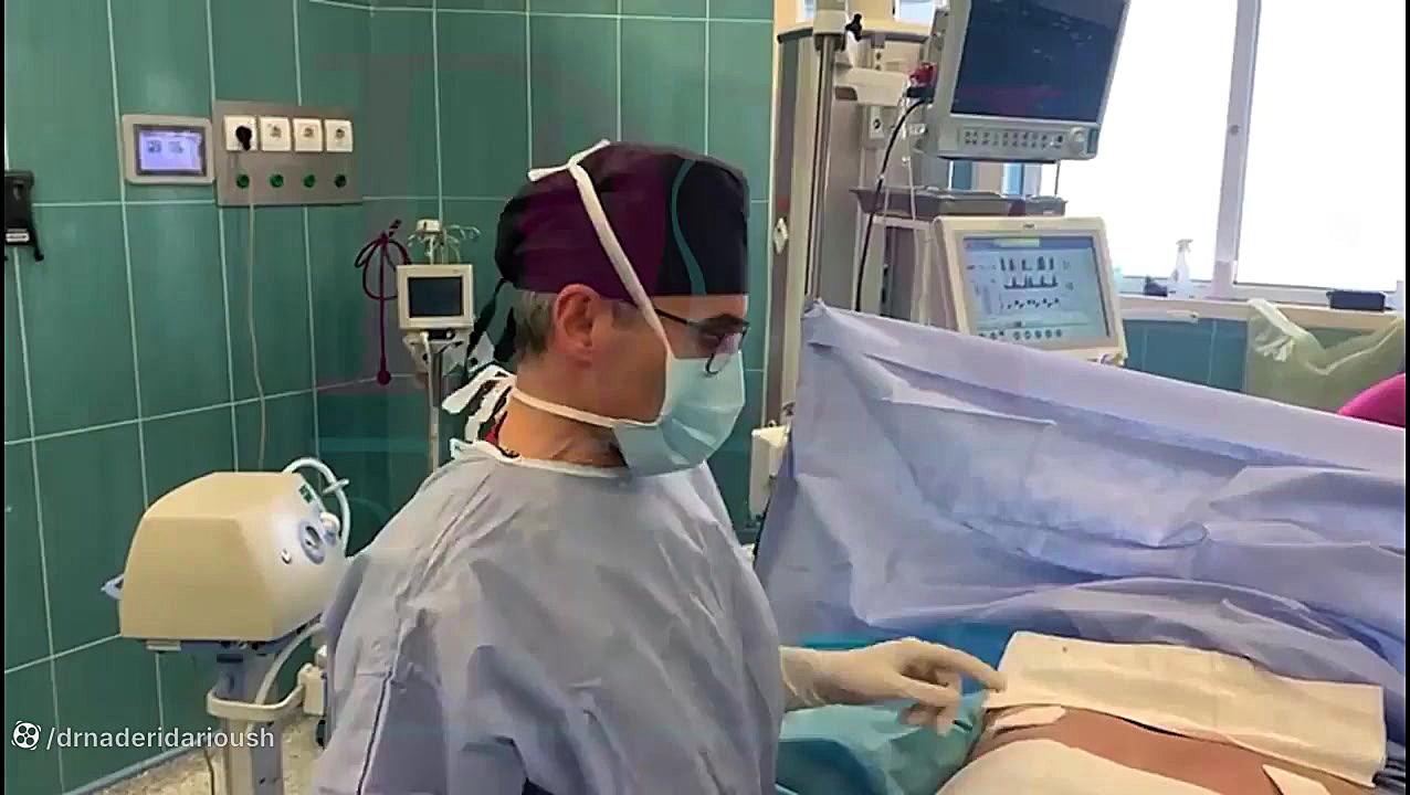 فیلم واقعی ژنیکوماستی در اتاق عمل برداشتن خال گوشتی