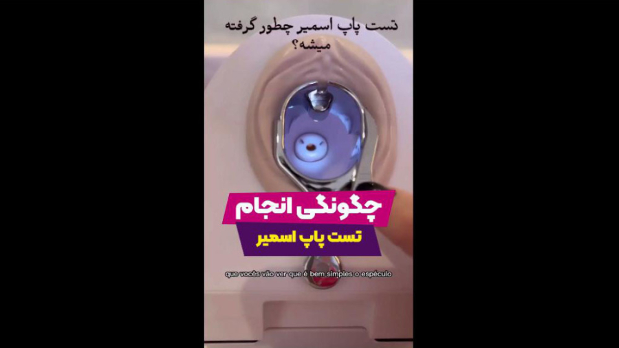 چگونگی انجام تست پاپ اسمیر کلینیک پوست