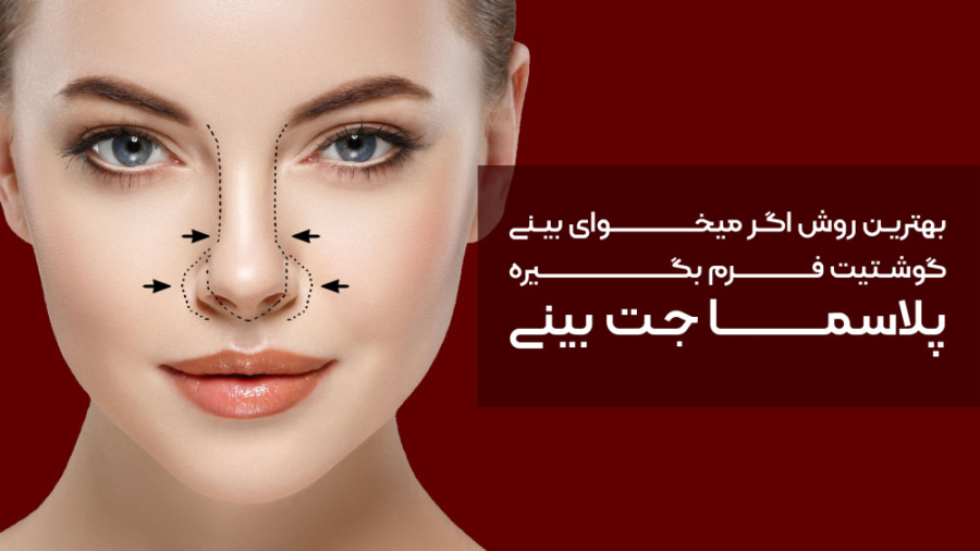 پلاسما اسپارک بینی روش تضمینی برای فرم دهی بینی الکترود اپتوژنزی