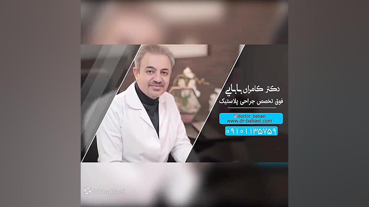 فیلم واقعی جراحی بینی گوشتی با انحراف بسیار زیاد دکتر کامران بابایی