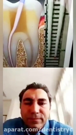 وجود لکه خون ، صرفا در انتهای paper point