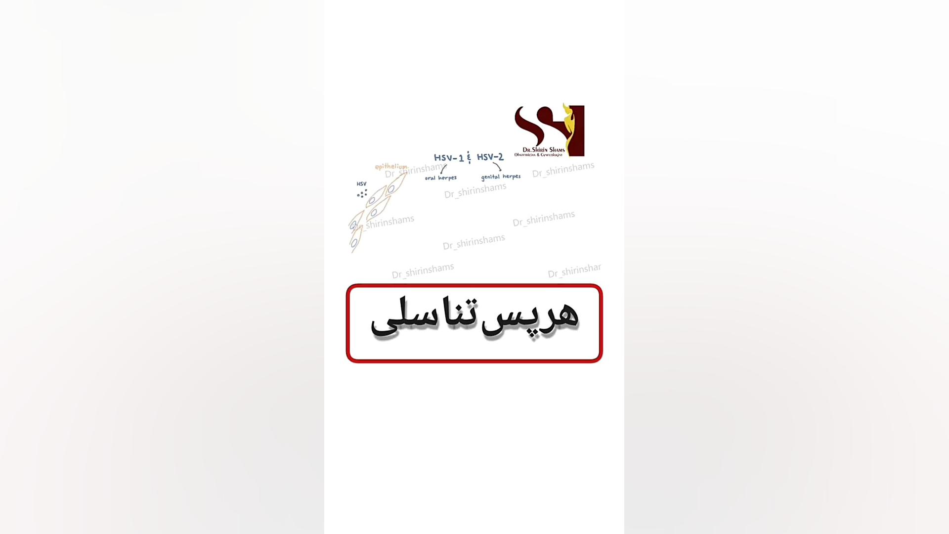 هرپس (تبخال) تناسلی دکتر شیرین شمس جراح و متخصص زنان و زایمان