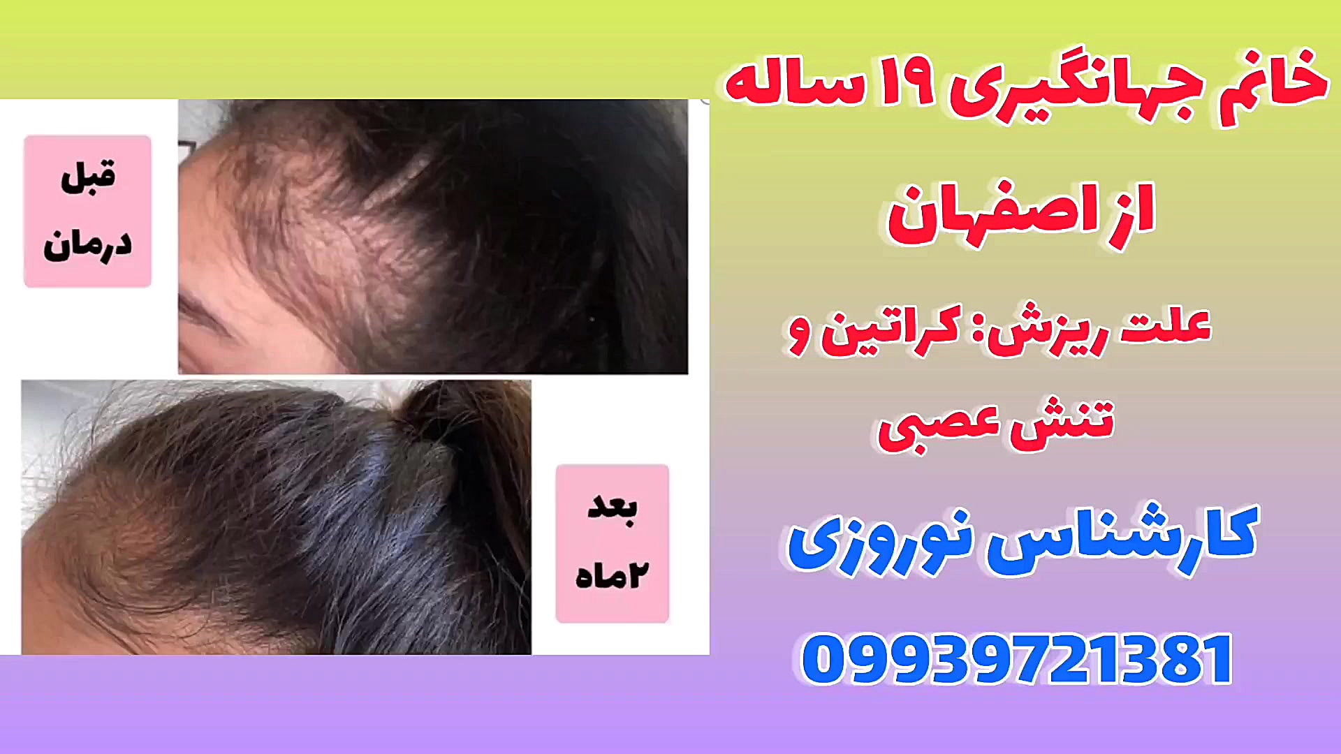 درمان خانگی ریزش مو پرت و پلا