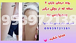 درمان ریشه ای پسوریازیس