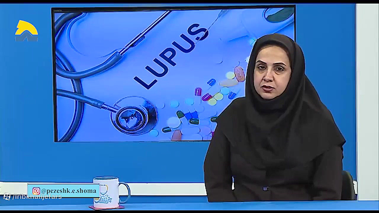 درمان بیماری لوپوس روکش دندان