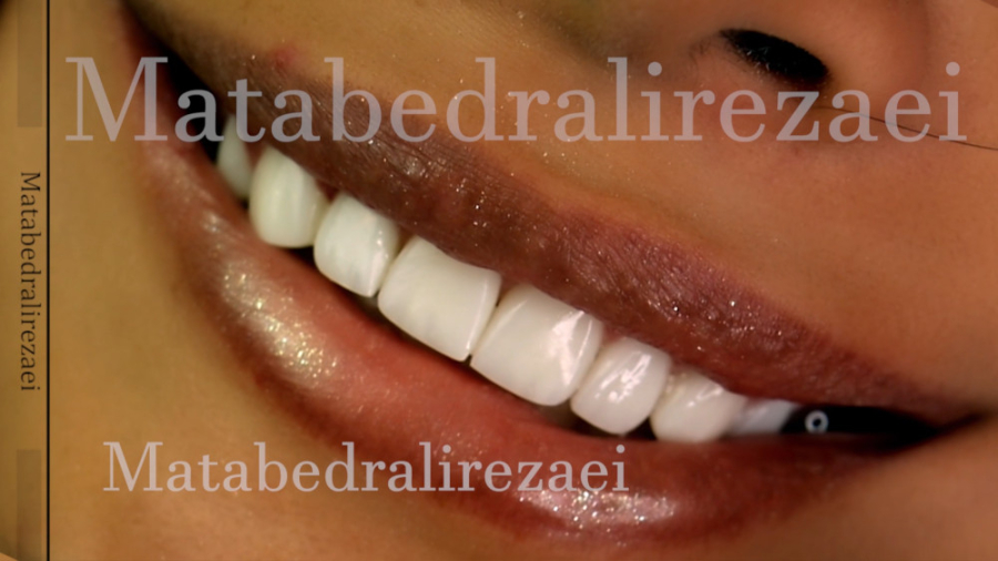 لبخند زیبا مطب دکتر علیرضایی