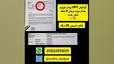 درمان زگیل تناسلی حلزون توربو