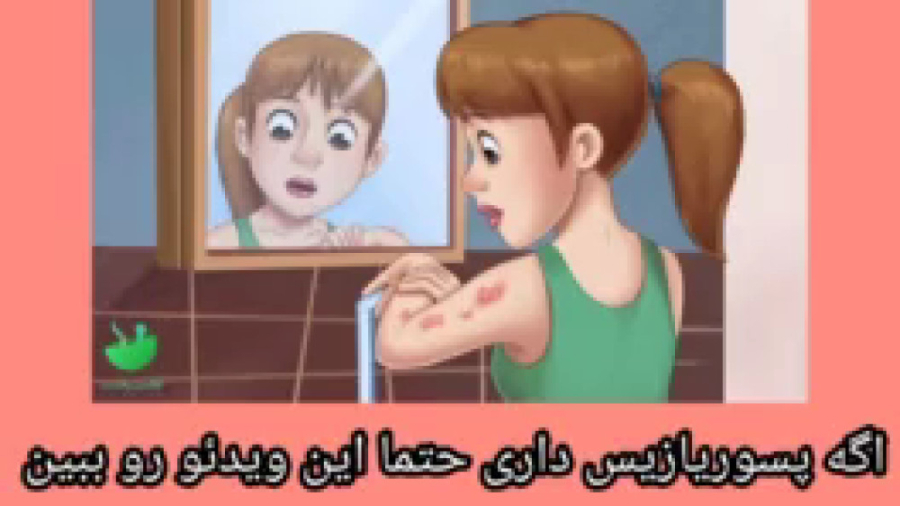 درمان پسوریازیس کاشت مو