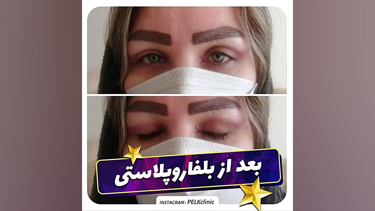 کلینیک زیبایی پلک پزشکی میکروRNA