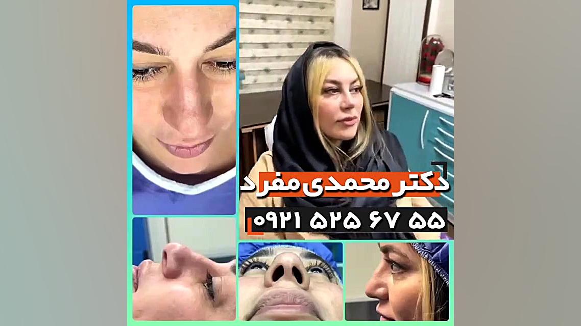 عمل زیبایی بینی ، دکتر امیرحسین محمدی مفرد 09215256755 دکتر امیر حسین محمدی مفرد