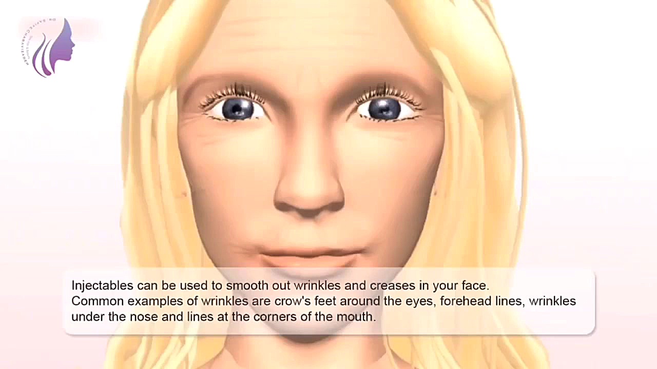 تفاوت ژل و بوتاکس چیه؟ دکتر صفیه چعباوی زاده