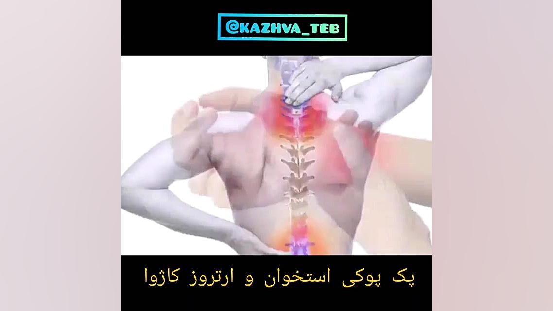 درمان پوکی استخوان پریودنتیکس