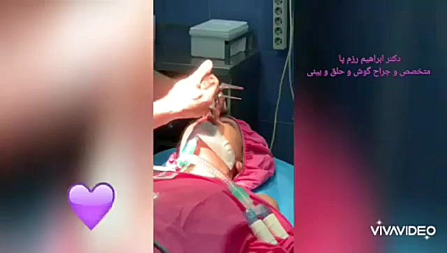 ویدیو اتاق عمل جراحی بینی دکتر رزم پا لیفت گردنایمپلنت دندان