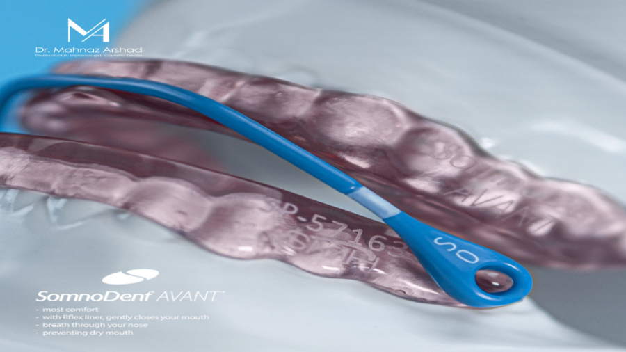 معجزه درمان خروپف با دستگاه دهانی دکتر مهناز ارشد