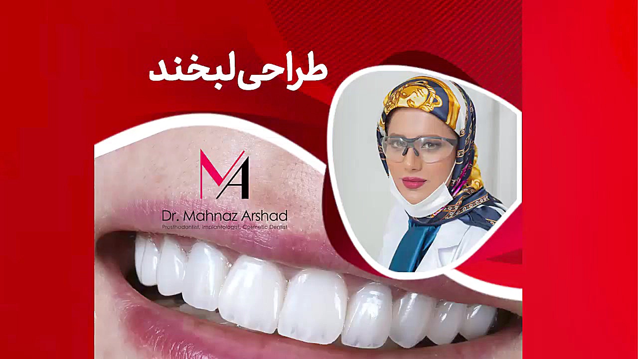 طراحی لبخند دکتر مهناز ارشد