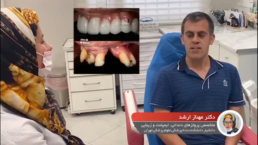طراحی لبخند در شکاف کام دکتر مهناز ارشد
