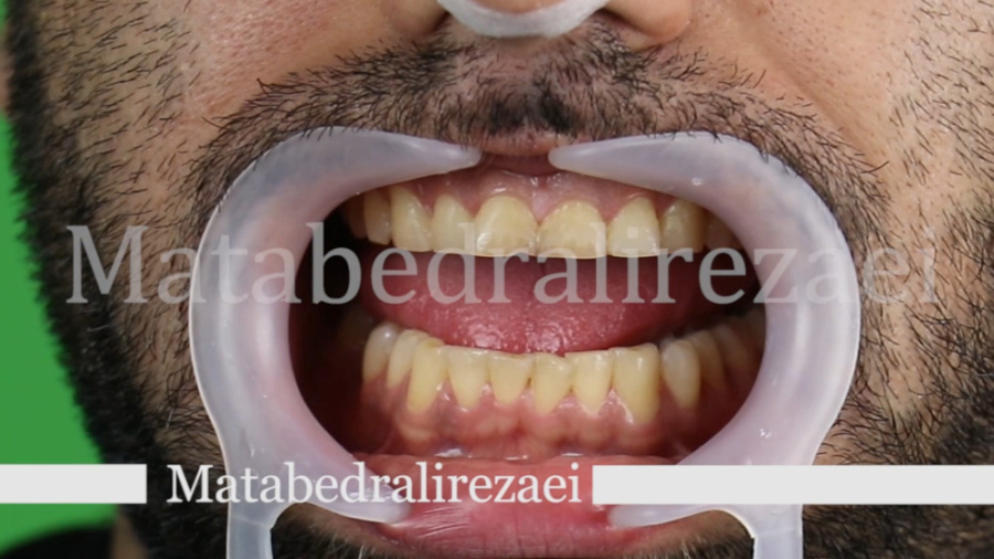 با اعتماد بنفس لبخند بزن مطب دکتر علیرضایی