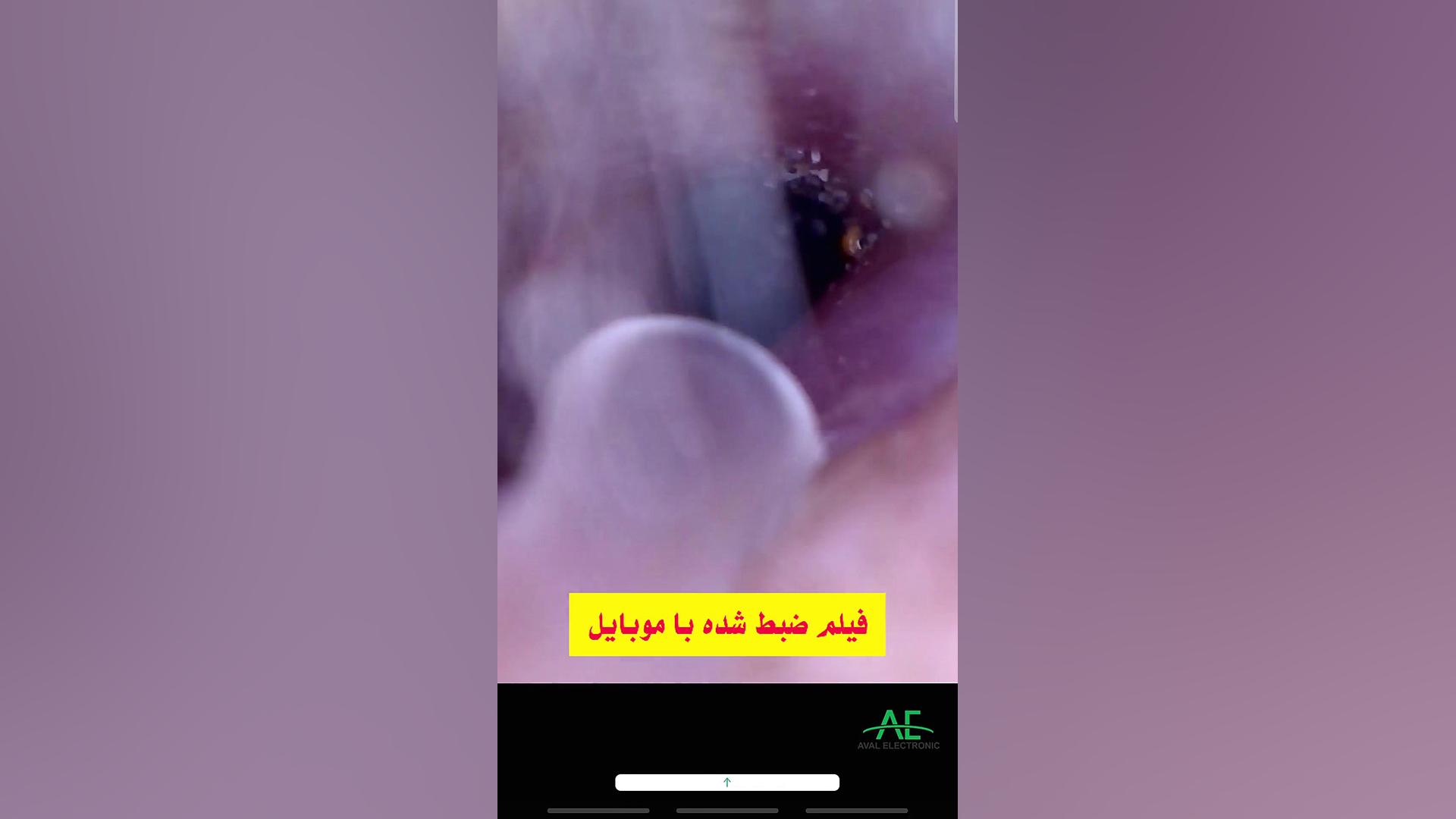اتوسکوپ دوربین معاینه داخل گوش Visiual Earpick کیتی پری