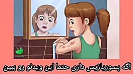 درمان پسوریازیس جراحی زیبایی پلک