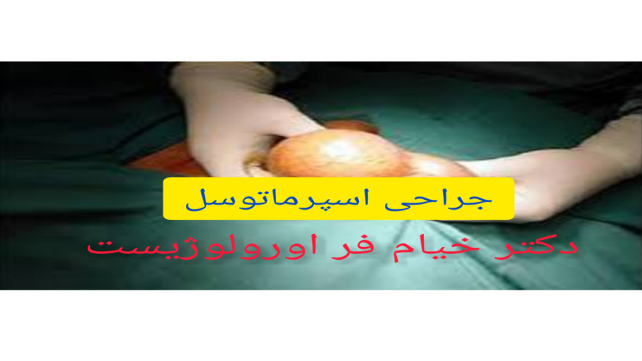 جراحی اسپرماتوسل_دکتر خیام فر فوق تخصص اورولوژی درمان جای جوش