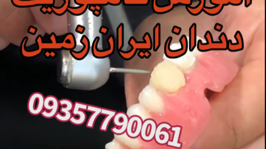 آموزش کامپوزیت دندان آموزش عصب کشی دندانپزشکی دندانسازی پرکردن دندان تست مهار دگزامتازون