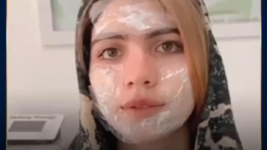 مزوتراپی صورت و تزریق آنزیم دستکش جراحی حساسیت بالا