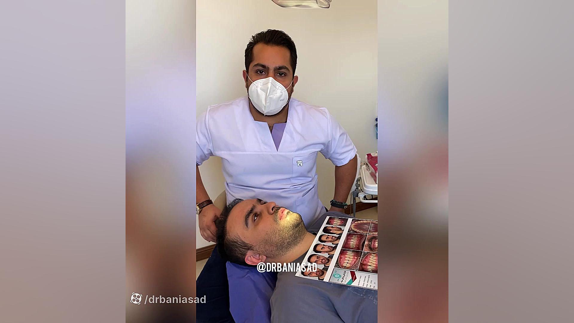 پروسه درمان بیمار با غیبت مادرزادی یک دندان - دکتر نیما بنی اسد متخصص ارتودنسی دکتر نیما بنی اسد - متخصص ارتودنسی در تهران