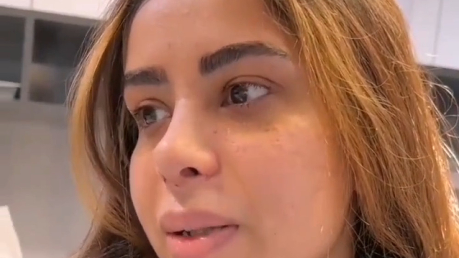 نمونه کار جراحی بینی | دکتر محمد علی حسینی آزمون فعالیت آنزیم G6PD