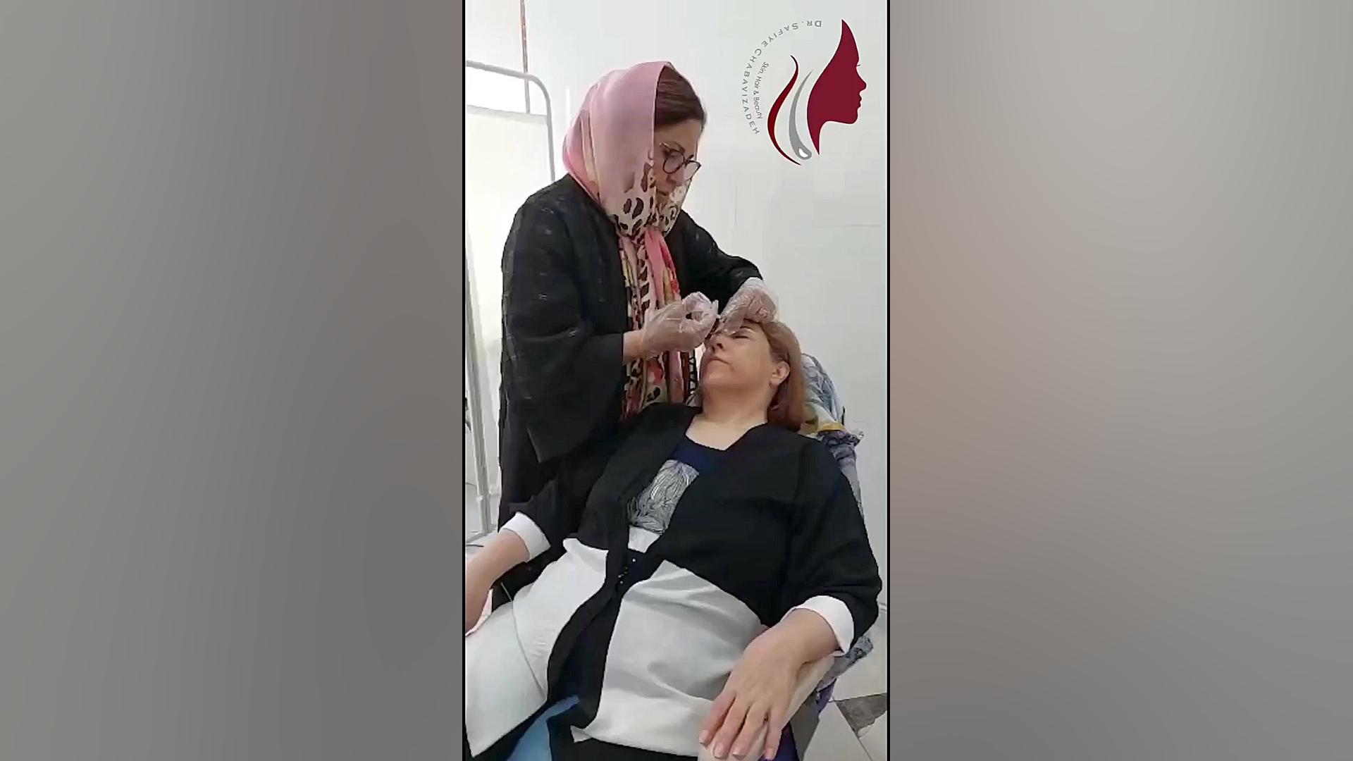 تزریق بوتاکس بدون درد دکتر صفیه چعباوی زاده