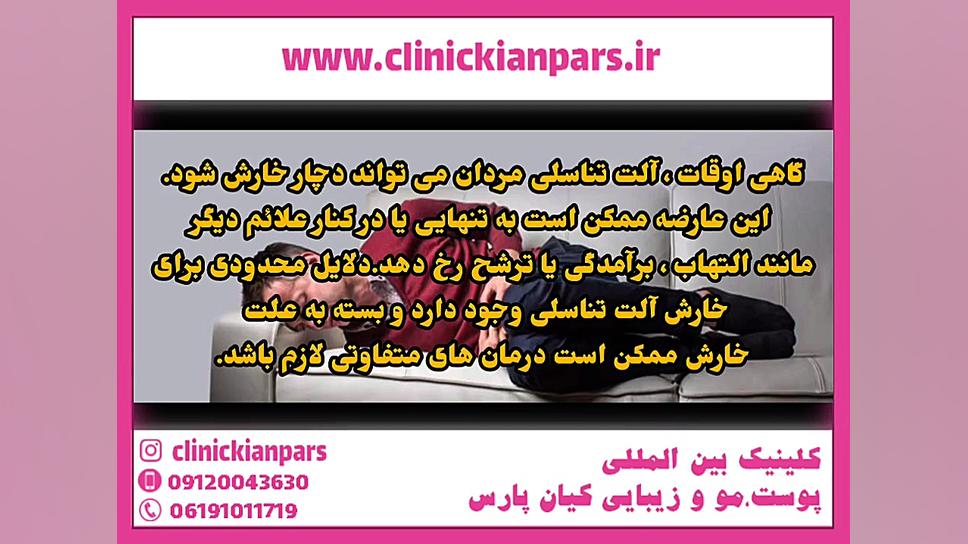 خارش دستگاه تناسلی مردان دندان پیش