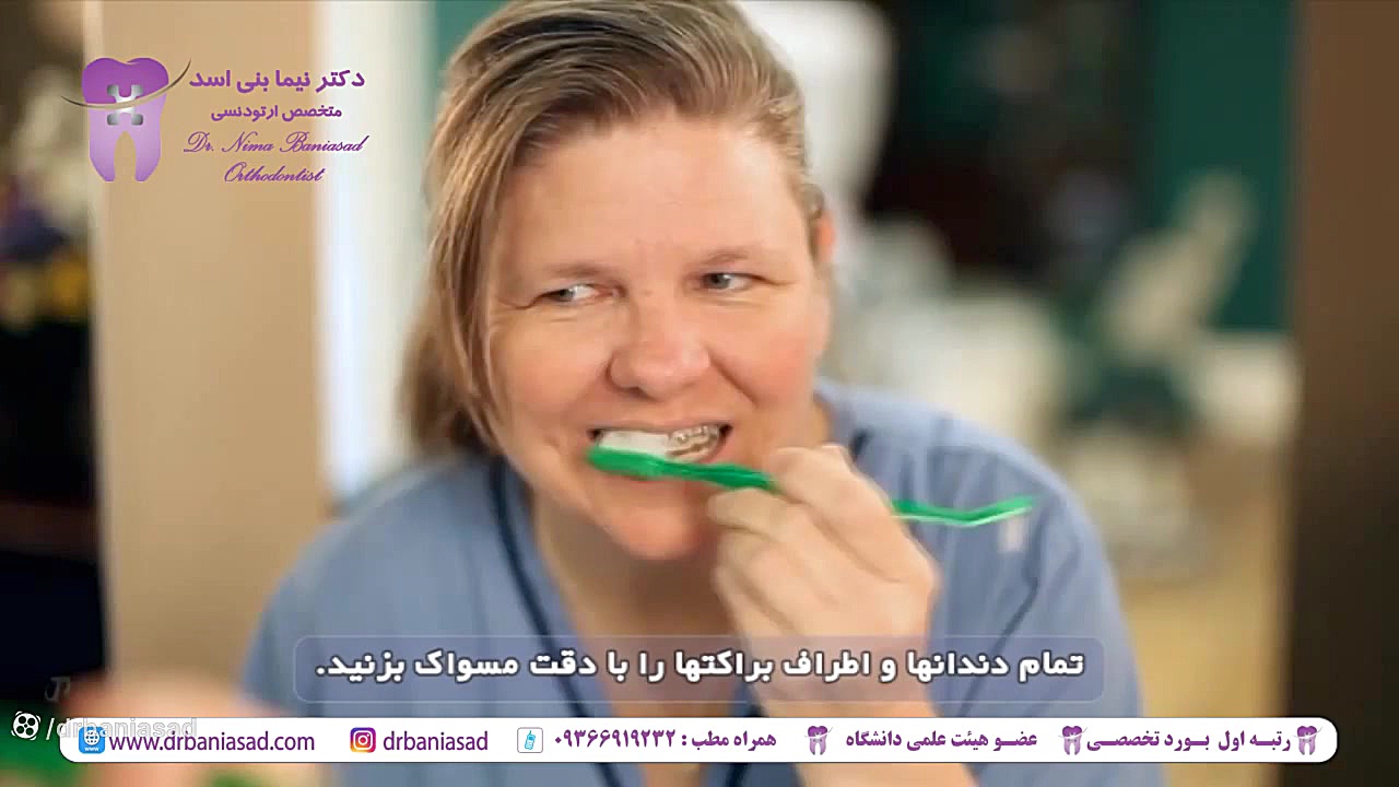 مراقبت های بهداشتی حین درمان ارتودنسی - دکتر نیما بنی اسد دکتر نیما بنی اسد - متخصص ارتودنسی در تهران
