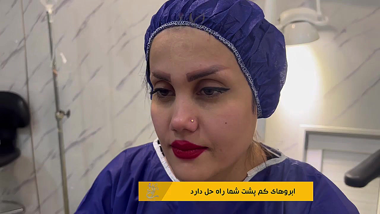 کاشت ابرو دستگاه لیزر پالس فمتوثانیه