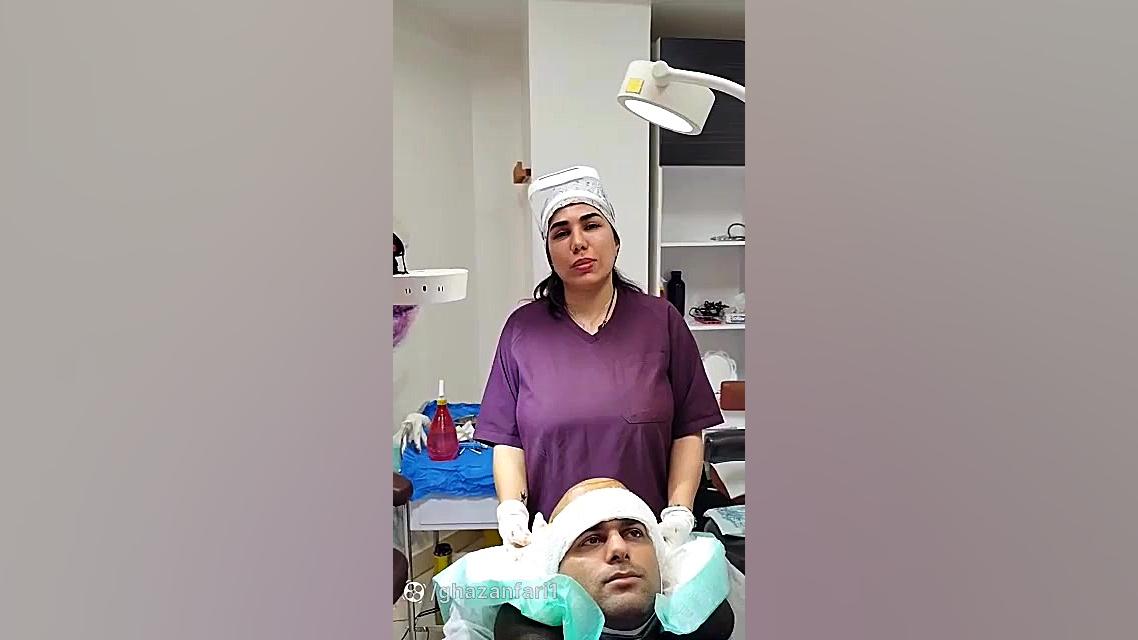 کاشت مو تهران آزمایش شمارش رتیکولوسیت