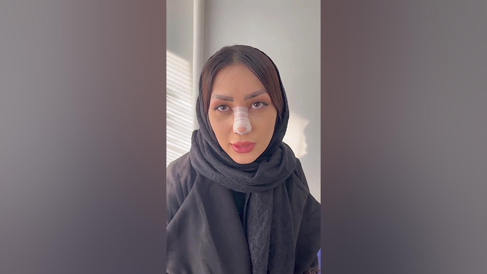 جراحی زیبایی بینی گوشتی 10 شهریور 1401 - دکتر مهرداد مقیمی دکتر مهرداد مقیمی