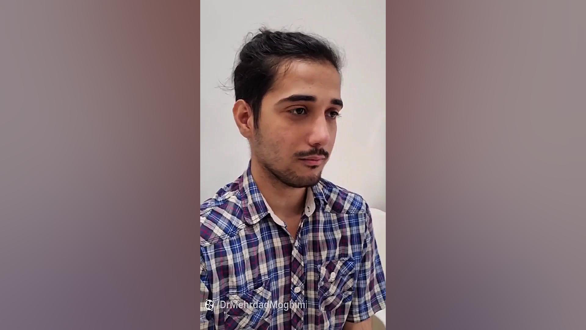 جراحی زیبایی بینی گوشتی 3شهریویر 1401 - دکتر مهرداد مقیمی دکتر مهرداد مقیمی