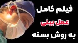 فیلم کامل جراحی بینی - عمل بینی - کلیپ عمل بینی
