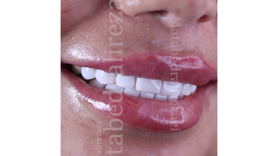 رضایتو در چهره اش میشه دید مطب دکتر علیرضایی