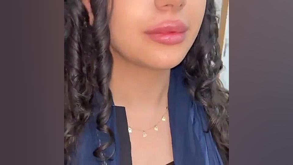 تزریق یک سی سی ژل لب مدل روسی در کلینیک زیبایی دکتر پرستو بهرامی تست آنتی‌بادی مونوکلونال