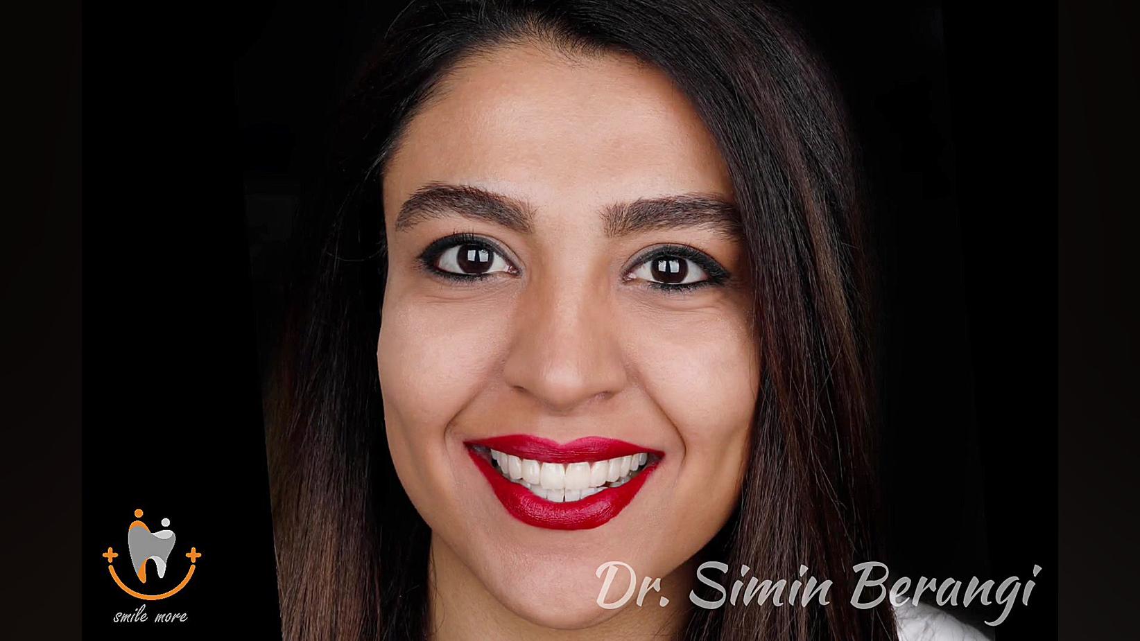 نمونه کار 24 ام دکتر سیمین برنگی دکتر سیمین برنگی | Dr Simin Berangi