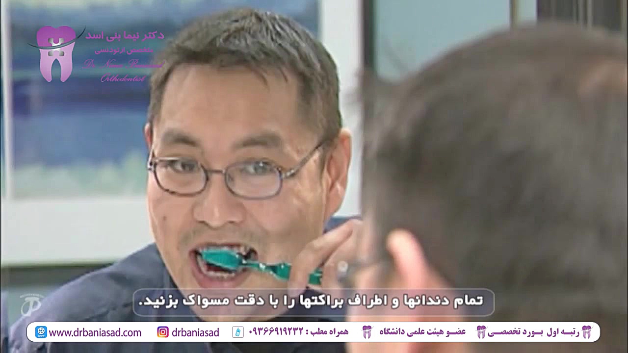 لکه های سفید (White Spot) در حین درمان ارتودنسی - دکتر نیما بنی اسد دکتر نیما بنی اسد - متخصص ارتودنسی در تهران