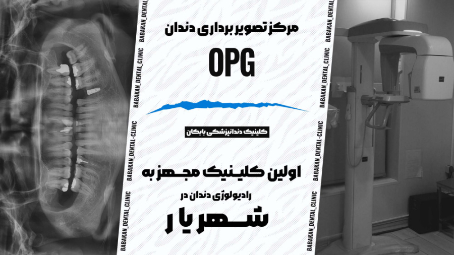 مرکز تصویر برداری عکس دندان (opg) کلینیک دندانپزشکی بابکان کلینیک دندانپزشکی بابکان