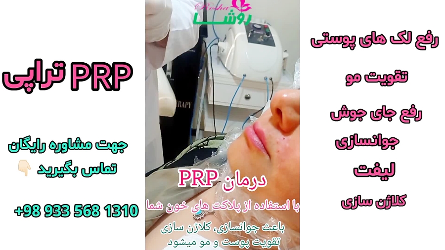 چرا پی آر پی انجام دهیم؟