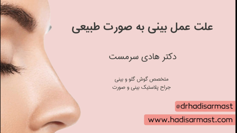 چرا عمل بینی را دکتر سرمست بصورت طبیعی انجام می دهند؟ بیماری ترومبوسایتوز اسنشیال